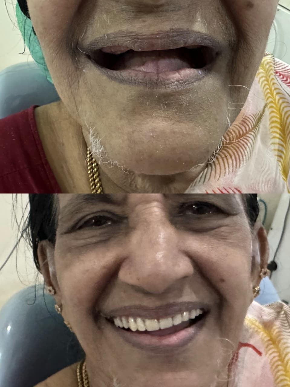 Esthetic Smile Correction